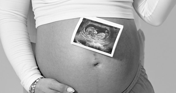Sesión de fotos preboda o book para hasta 5 personas