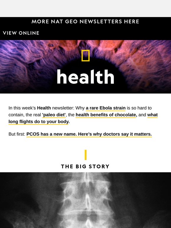 What long flights do to our bodies; the truth about PMOS; the risk of Ebola