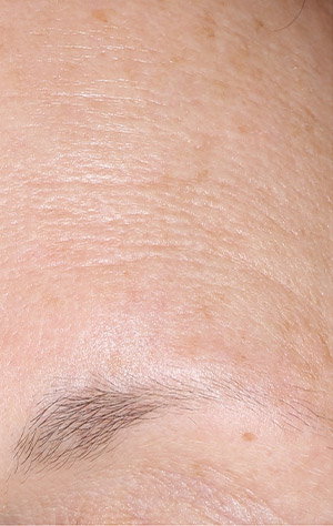 Woman's forehead with visible pores and wrinkles