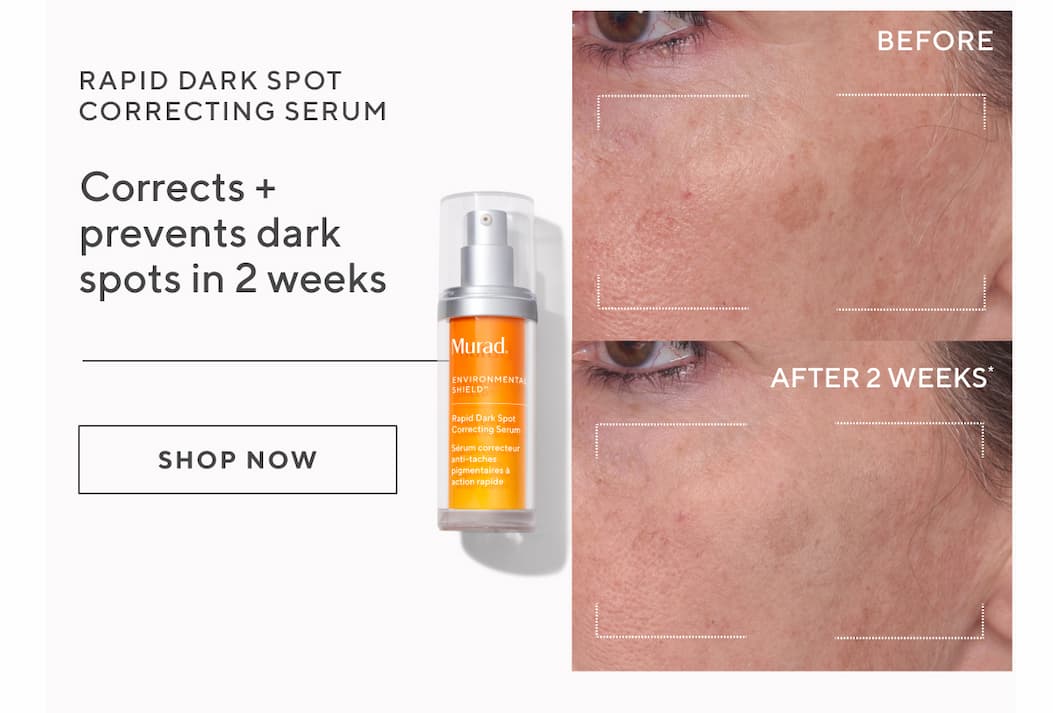 Rapid Dark Spot Correcting Serum