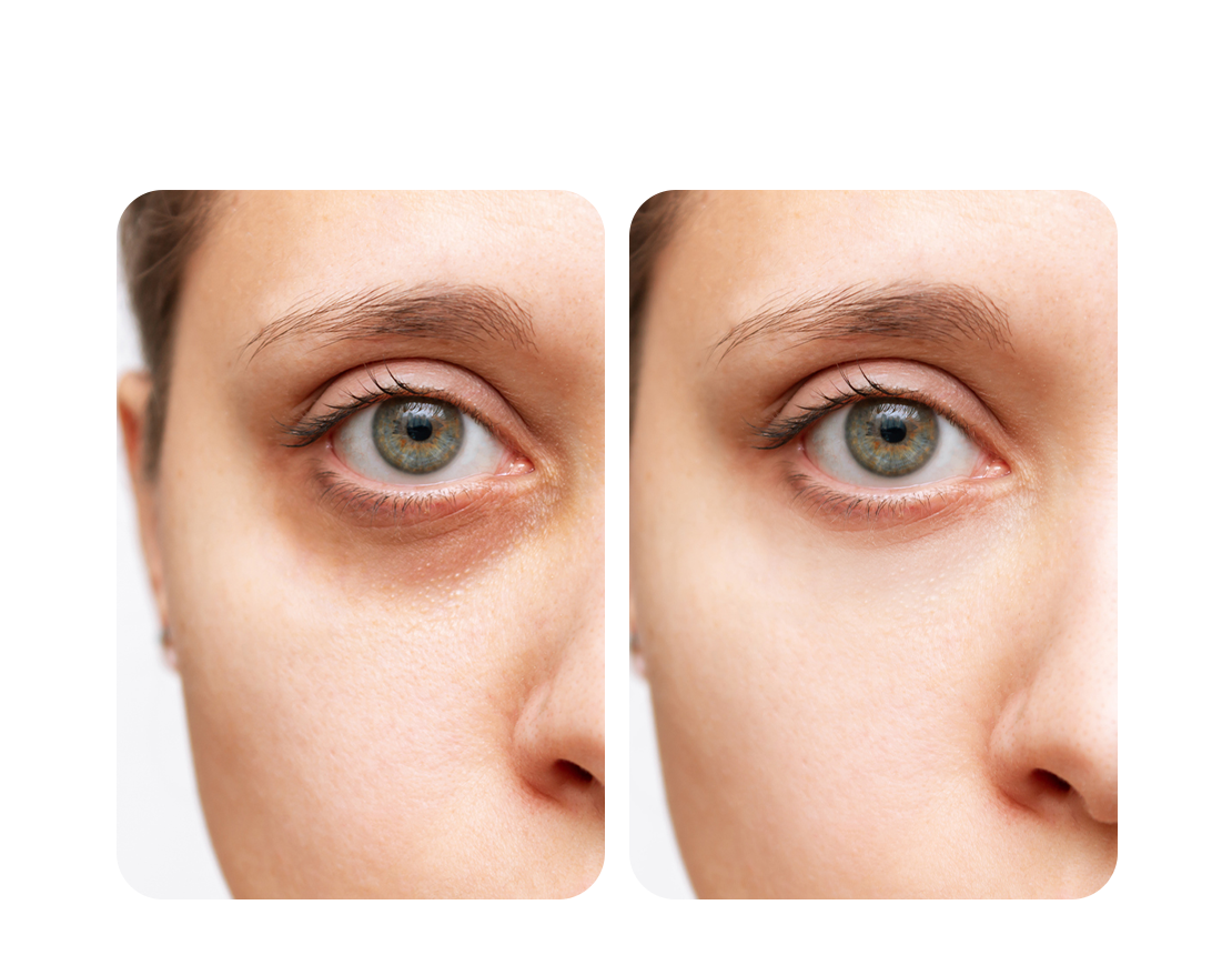 Visible Results