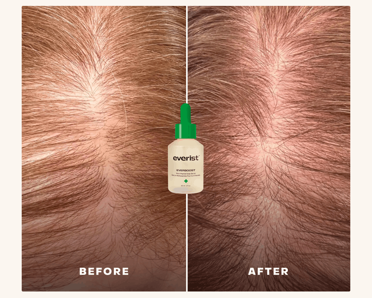 Before & After: EverBoost