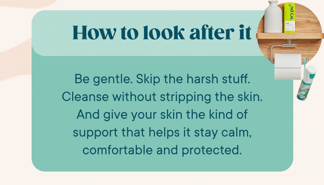 How to look after it