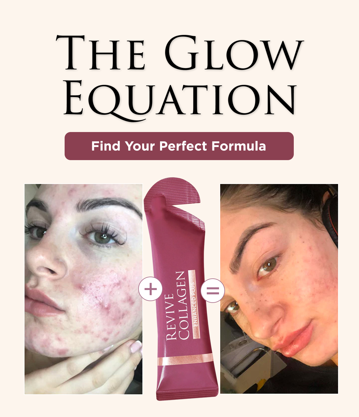 THE GLOW EQUATION