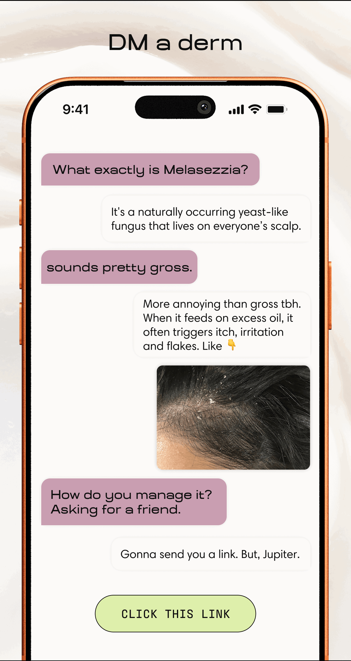 DM a derm | What exactly is melasezzia? It's a naturally occurring yeast-like fungus that lives on everyone's scalp. sounds pretty gross. More annoying than gross tbh. When it feeds on excess oil, it often triggers itch, irritation, and flakes. How do you manage it? Asking for a friend. Gonna send you a link. But, Jupiter. | CLICK THIS LINK