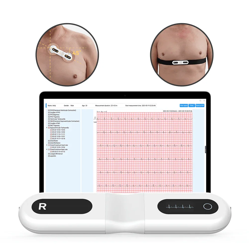 Wellue 24-Hour ECG Recorder