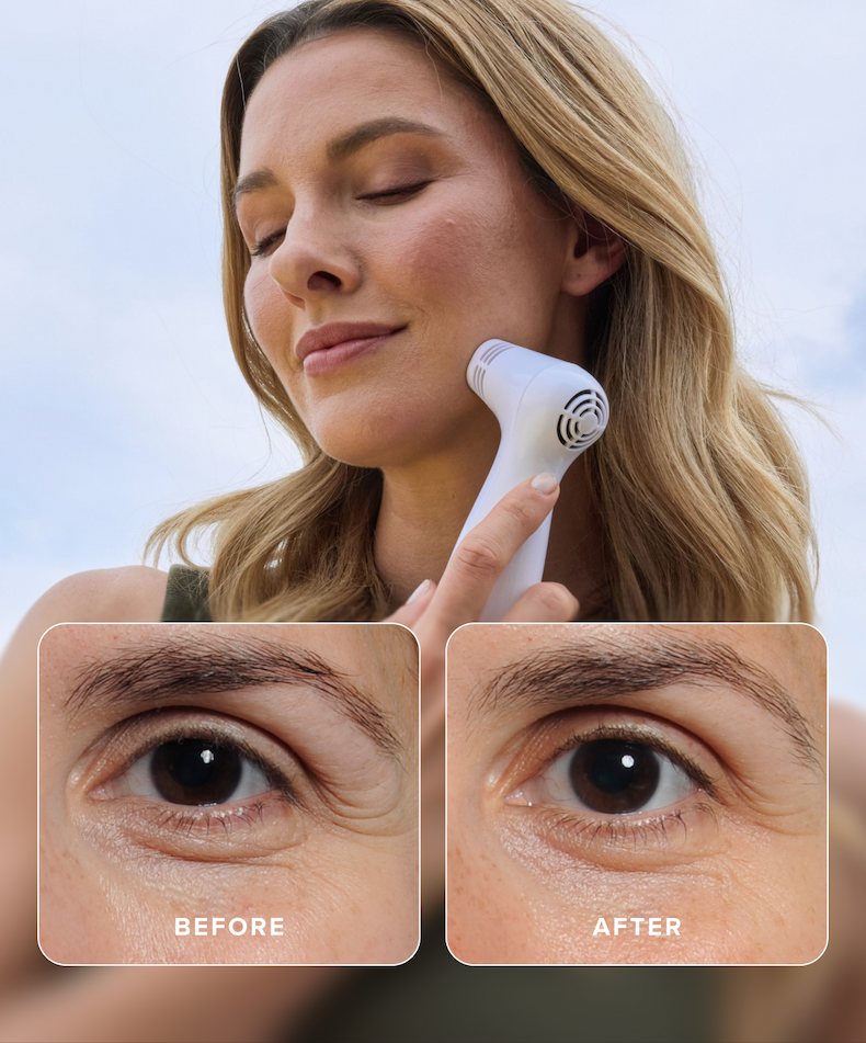NIRA is clinically proven to deliver 70x the wrinkle-fighting power.