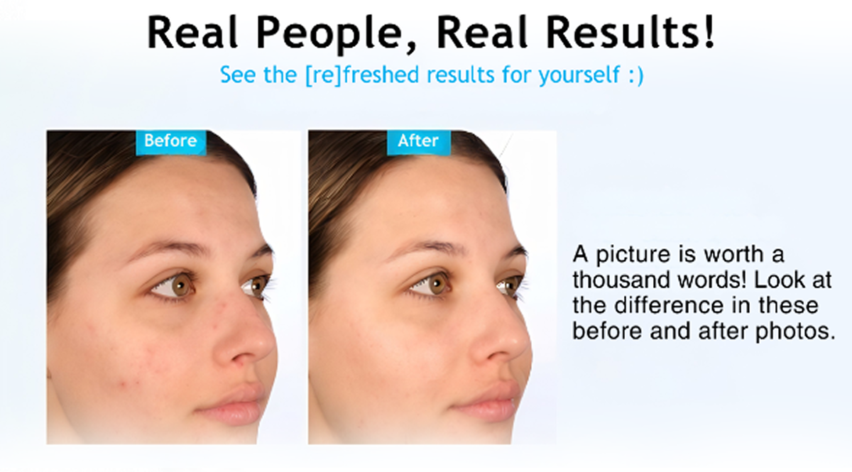 Before and After
