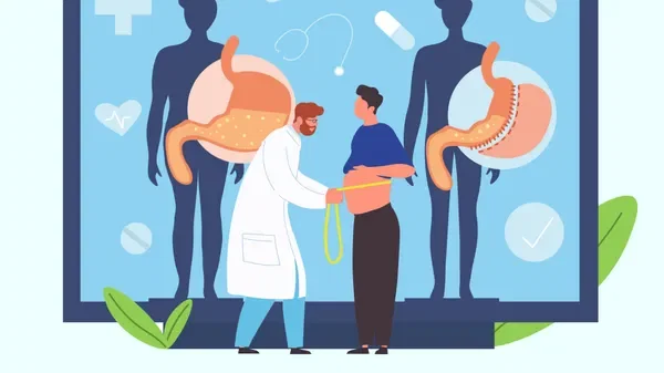 Qui peut bénéficier d'une chirurgie bariatrique en cas d'obésité ou de surpoids?
