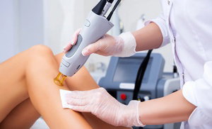Hair-Free and Carefree: Get 6 Hair Removal Sessions for Flawless Skin Hair-Free and Carefree: Get 6 Hair Removal Sessions for Flawless Skin