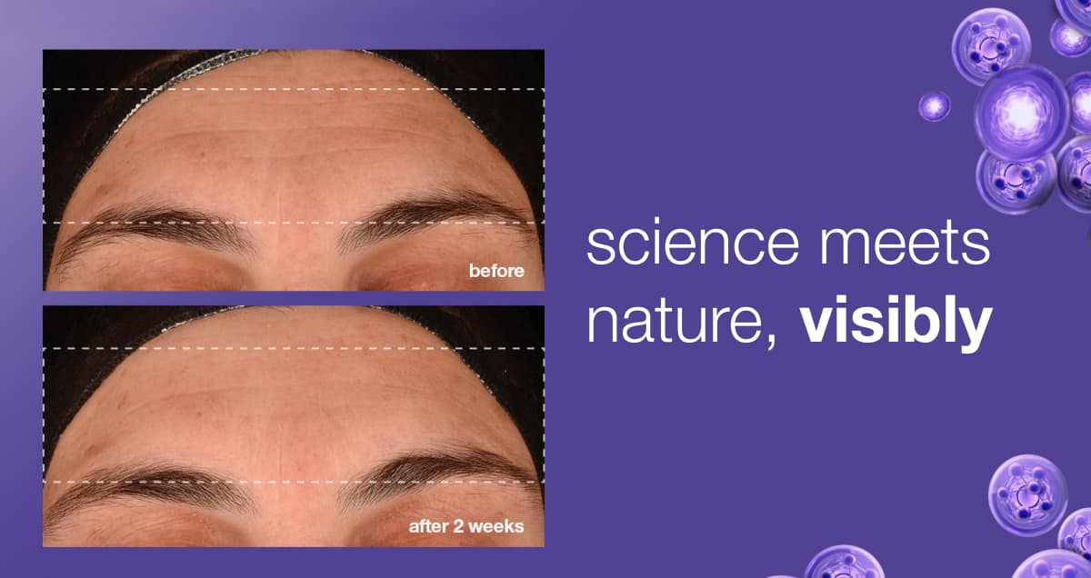 phyto nature e² regenerating daily exosome leave-on treatment