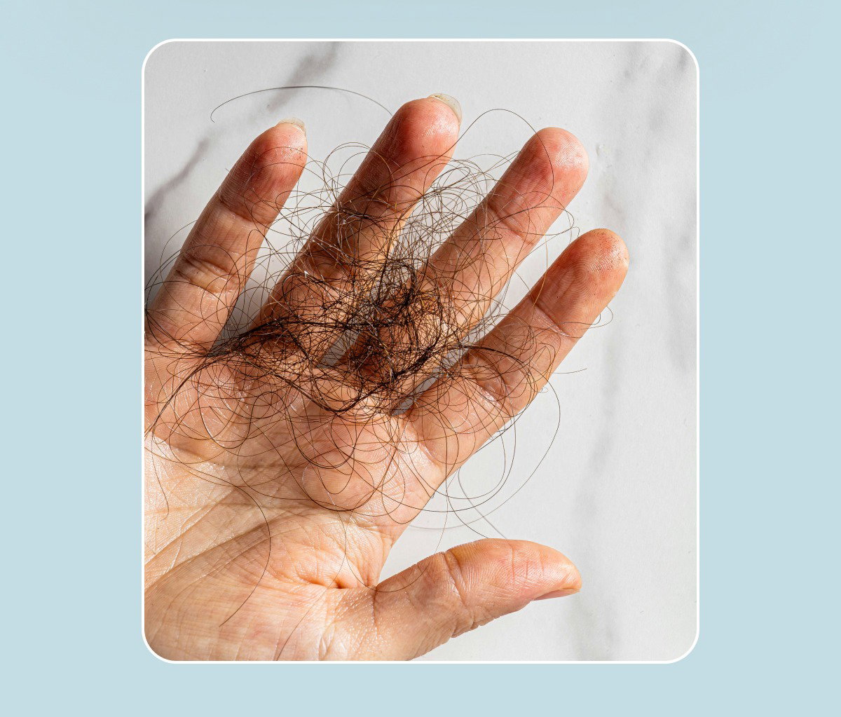 Get a head start on preventing summer shedding with Better Roots.