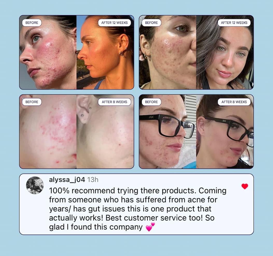 Before & After