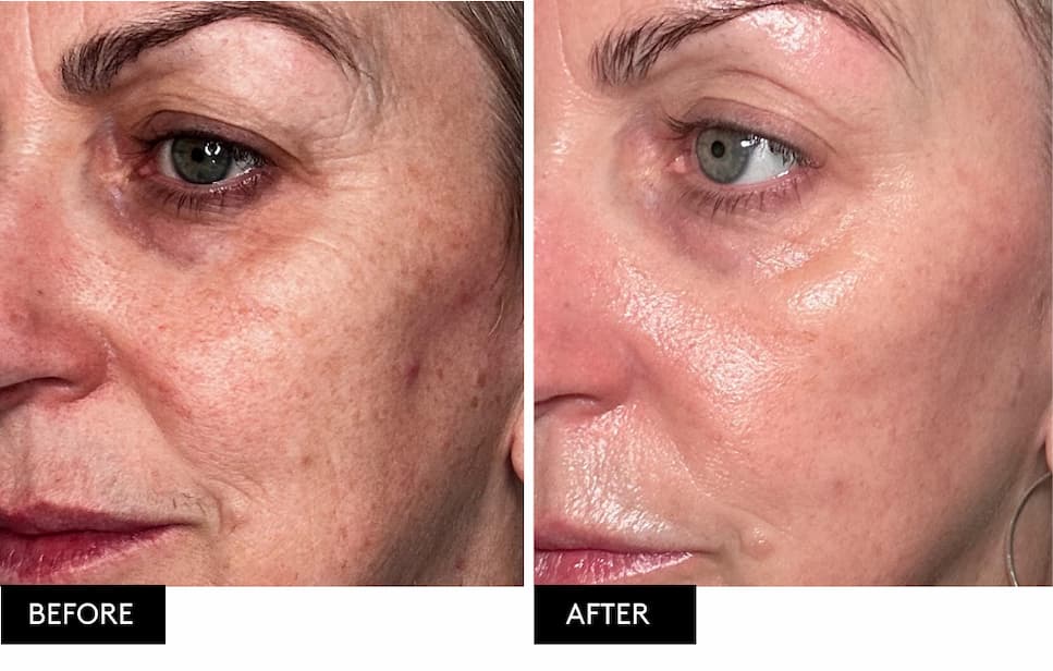 Pebble Pro Advanced Microcurrent & LED Facial Toning Device