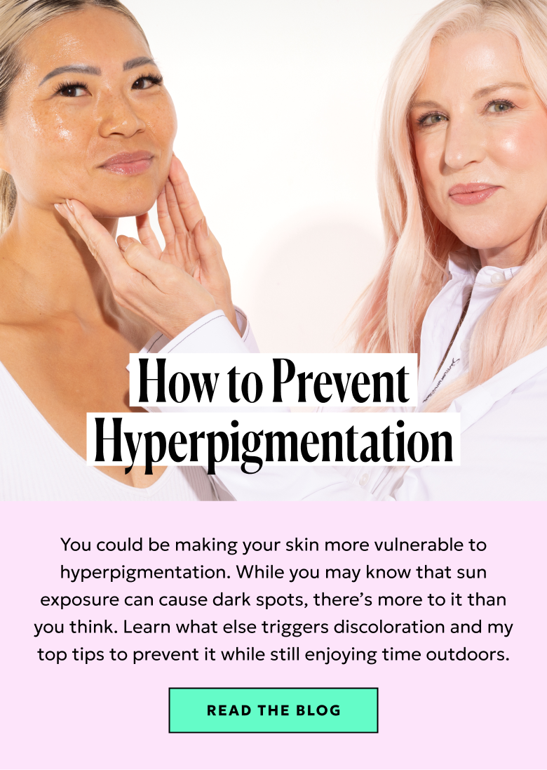 How to Prevent Hyperpigmentation: Learn what triggers discoloration and how to avoid it. Read the blog.