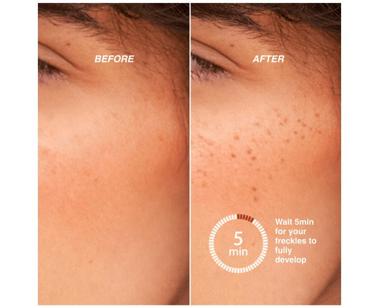 Before and After applying your freckle pen