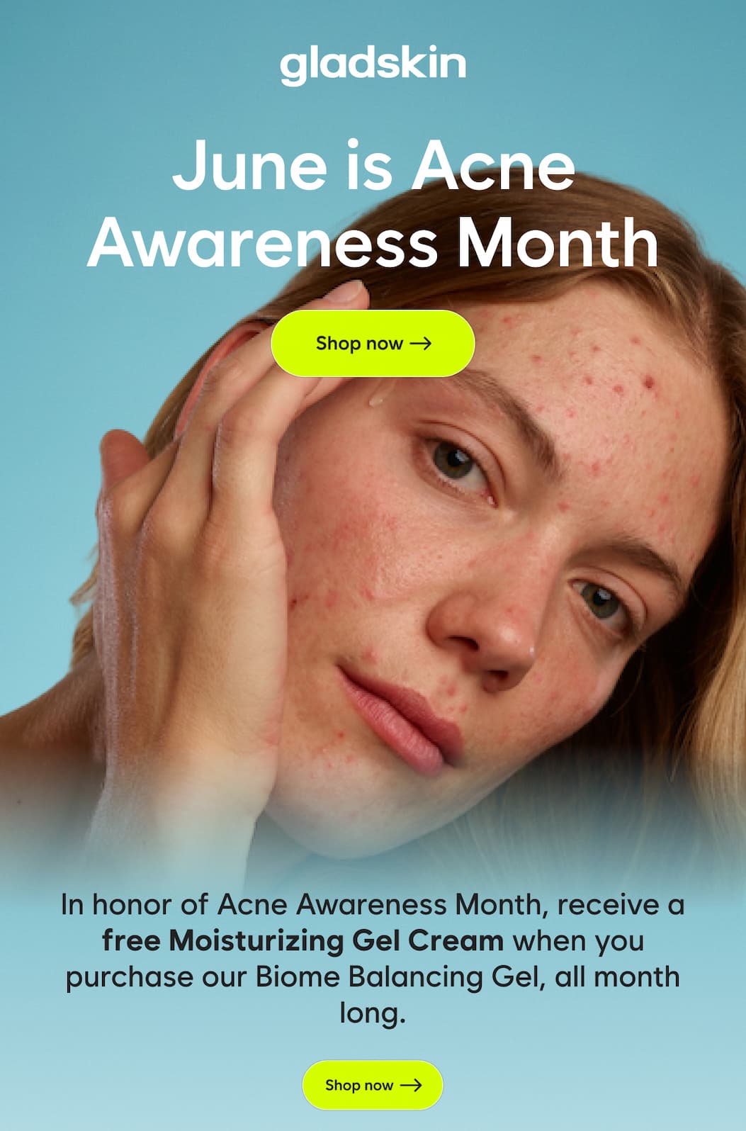 June is Acne Awareness Month  In honor of Acne Awareness Month, enjoy a free full-size Moisturizing Gel Cream when you purchase our Biome Balancing Gel — all month long.  Discover the gentle, soothing power of this lightweight gel duo, designed to help support sensitive skin.