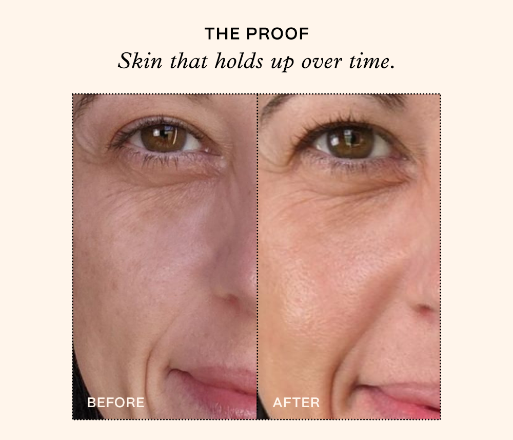 SHOP COLLAGEN HYDROFILLER