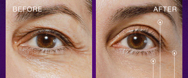 "Eye Treatment Product of the Year"