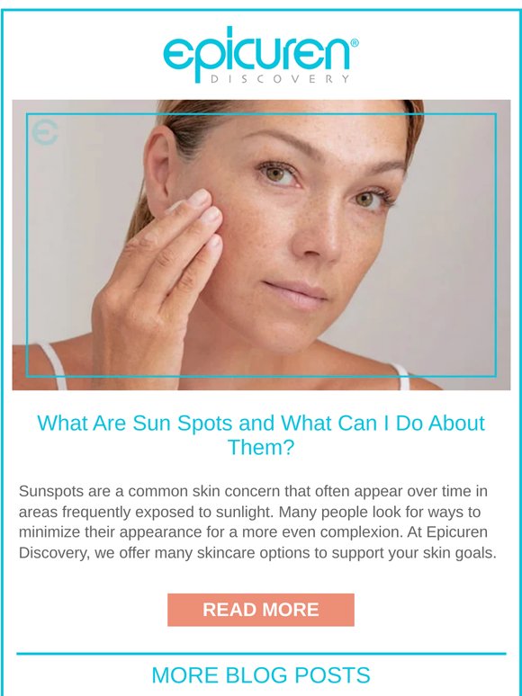 What Are Sun Spots and What Can I Do About Them? ☀️