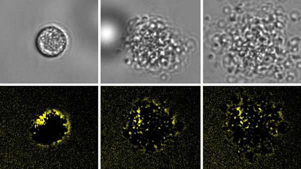Two rows of three microscopy images showing a ruptoblast — a newly discovered type of immune cell — degrading over time. The top row shows grayscale images, starting with a smooth, intact round cell on the left, followed by progressively more irregular and broken-up cellular structures in the middle and right images. The bottom row shows the same but in black and fluorescent yellow colours.