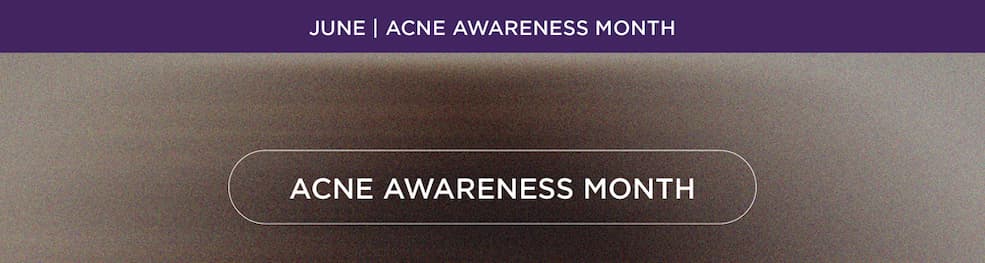 Acne Kit