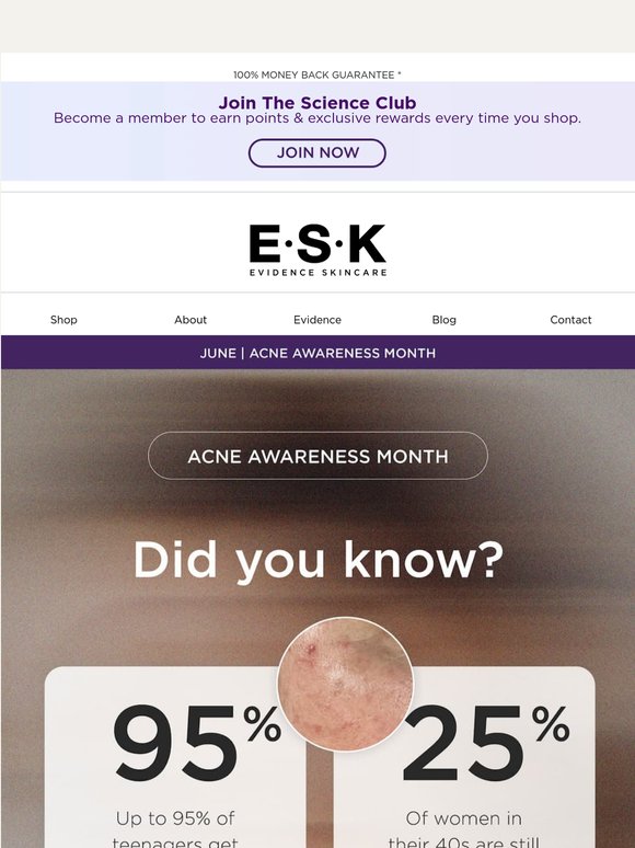 June is Acne Awareness Month 👀