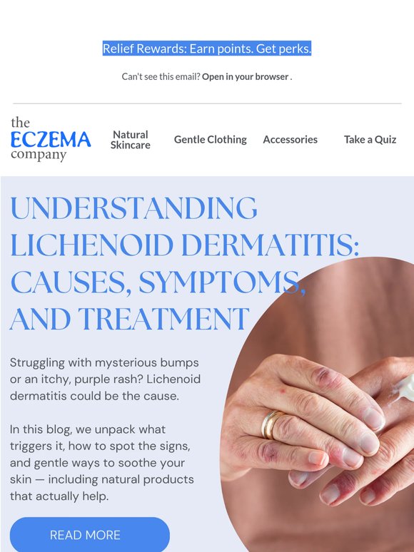 Itchy Purple Bumps on your Skin?