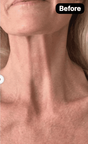 Ageless Throat & Decolletage Creme