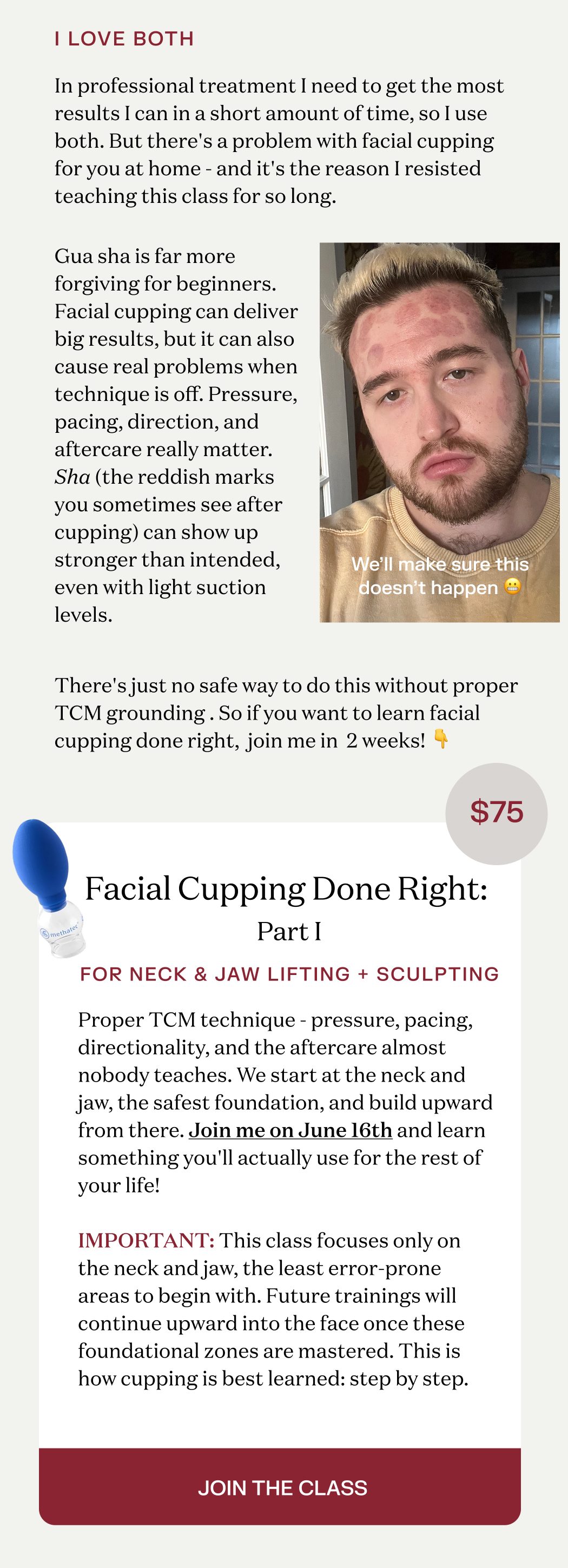cupping part 1