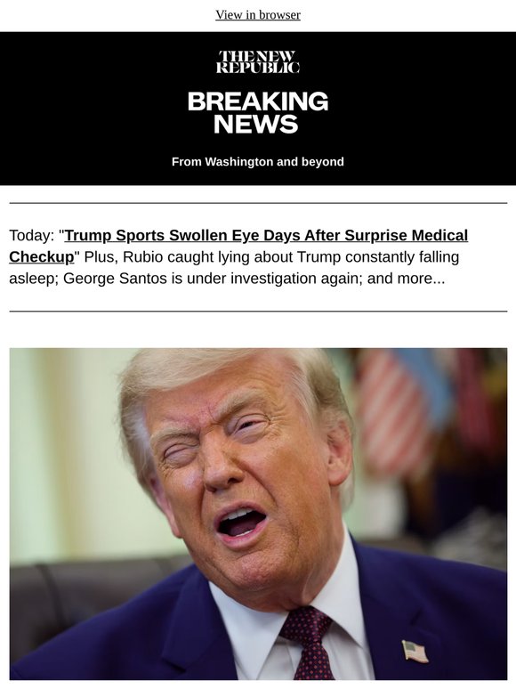 Trump Sports Swollen Eye Days After Surprise Medical Checkup