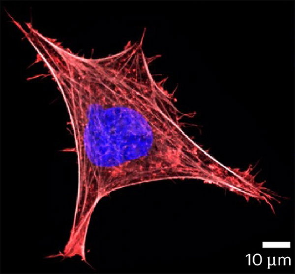 Confocal microscopy image showing the internal scaffold of a cancer cell (coloured in red) and its nucleus (blue).