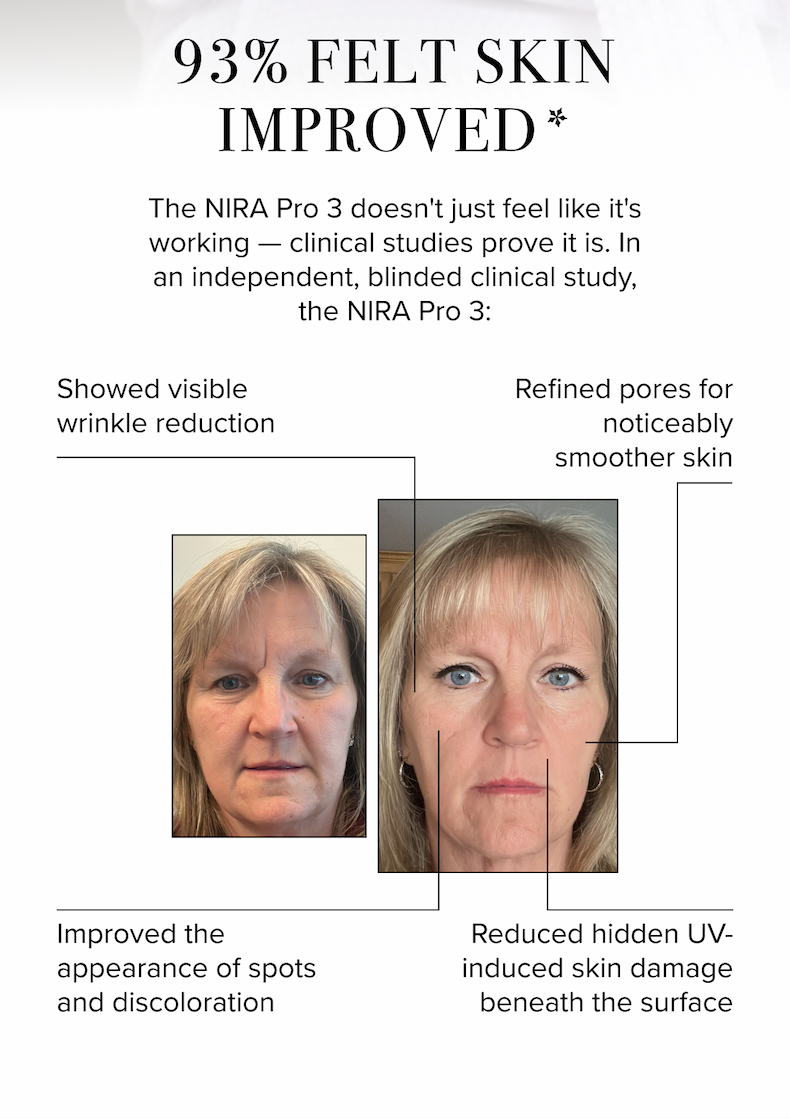 93% Felt Skin Improved* | The NIRA Pro 3 doesn't just feel like it's working — clinical studies prove it is. In an independent, blinded clinical study, the NIRA Pro 3: Showed visible wrinkle reduction, Refined pores for noticeably smoother skin, Improved the appearance of spots and discoloration, Reduced hidden UV-induced skin damage beneath the surface