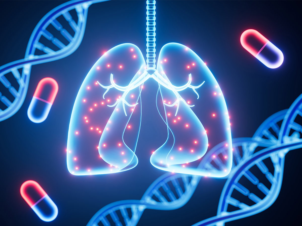 Illustration of therapies for lung diseases