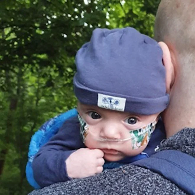 Image shows Fletcher, a baby who was born very prematurely. He is looking out over his dad's shoulder, wearing a dark blue hat. He has a breathing tube to support him which is secured to his cheeks with brightly-coloured tape.