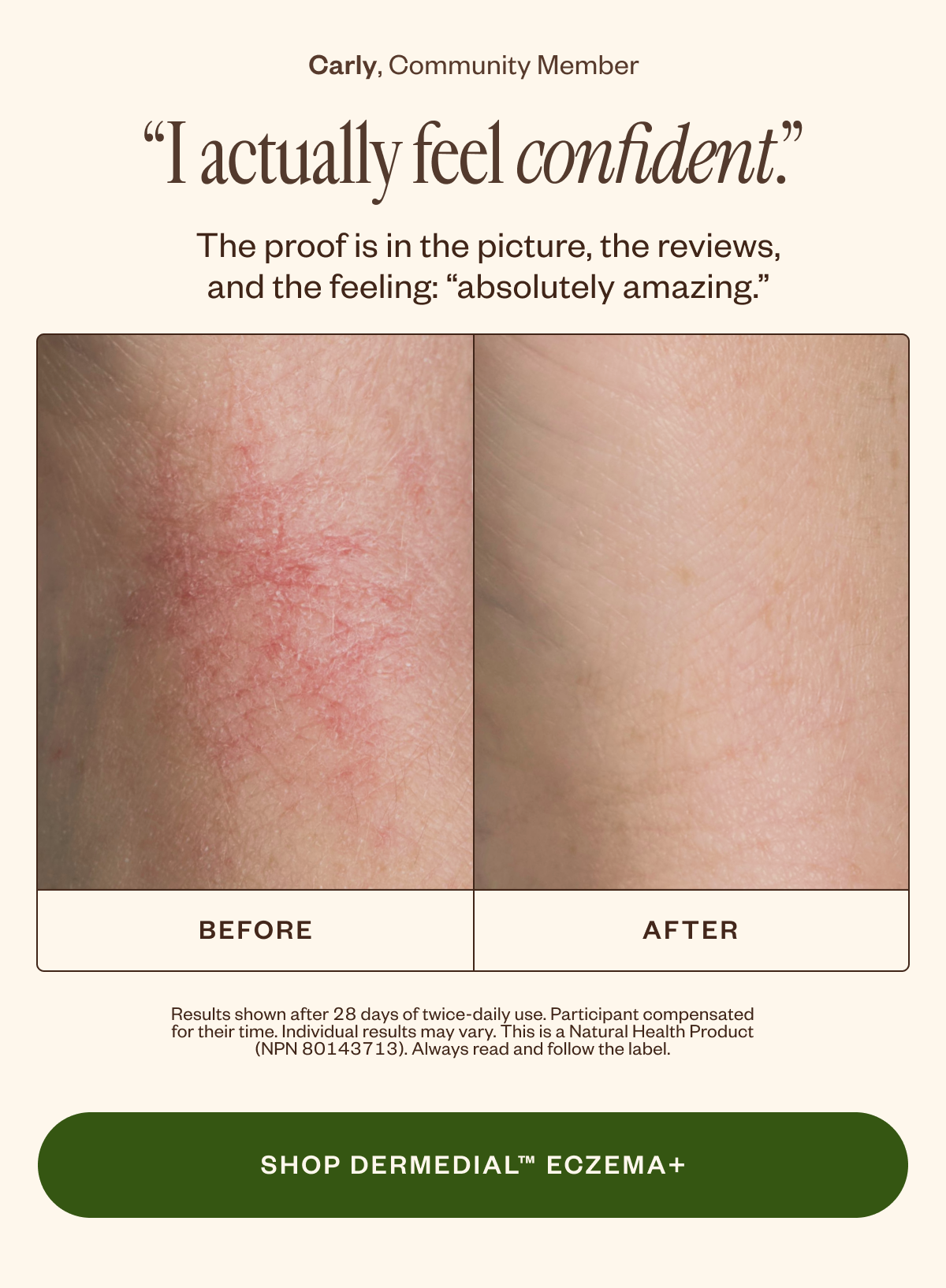 Shop Dermedial Eczema+.