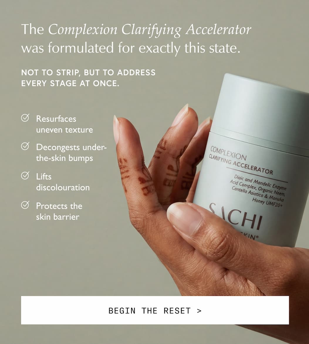 The Complexion Clarifying Accelerator was formulated for exactly this state.