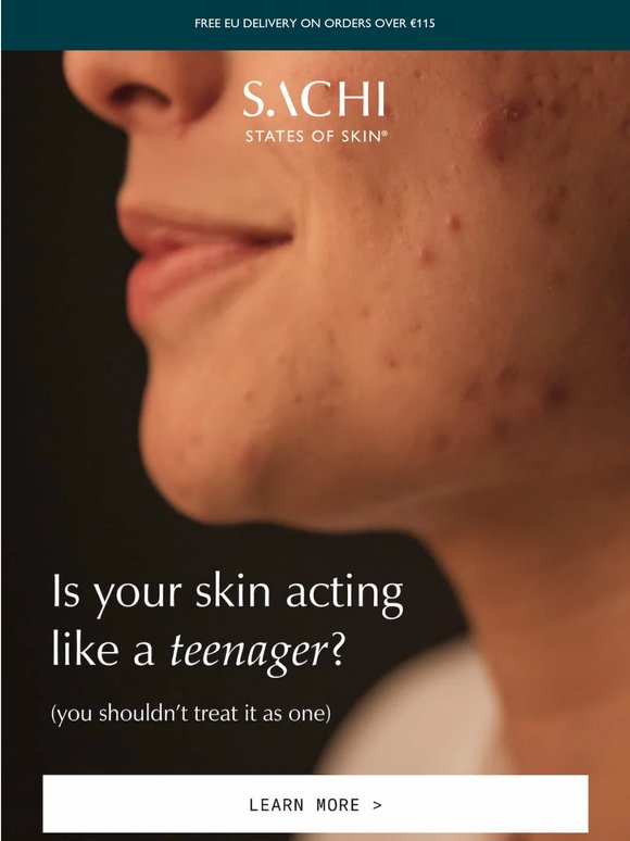 Adult acne is not the acne you had at 16.