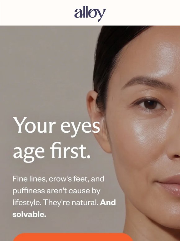 Crow's feet: normal. Keeping them: optional.