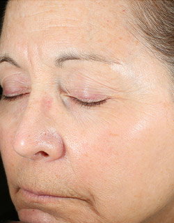 Same woman's face with even coloration and brighter skin