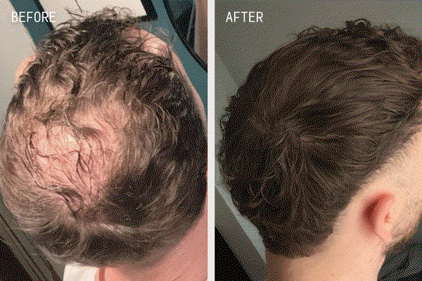 Before and After Images