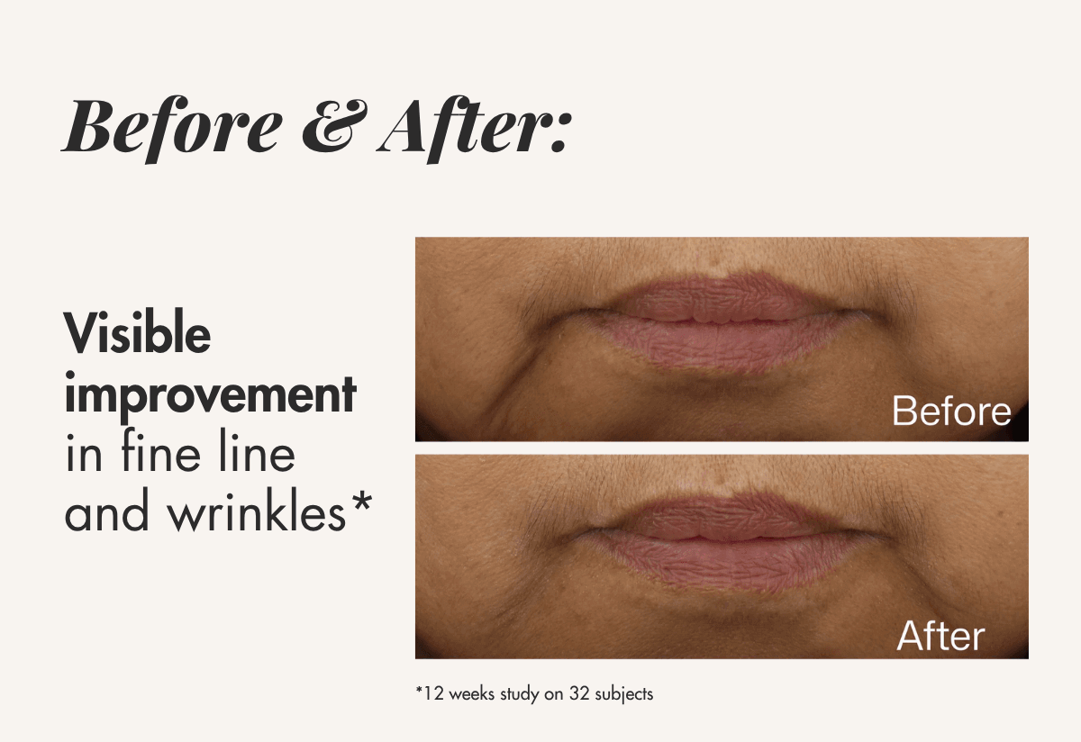 New EltaMD UV Daily Hydration+ Tinted SPF 50