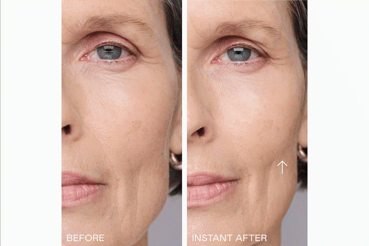 Before & After