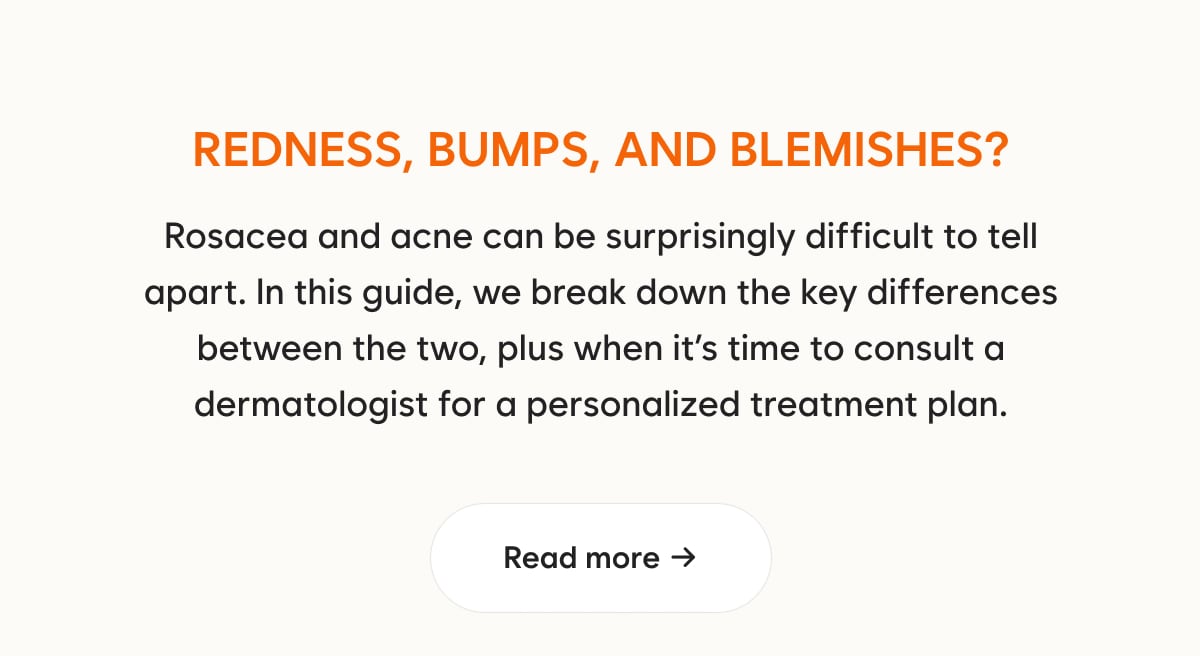 Redness, bumps, and blemishes? Rosacea and acne can be surprisingly difficult to tell apart. In this guide, we break down the key differences between the two, plus when it’s time to consult a dermatologist for a personalized treatment plan.  CTA: Read more →
