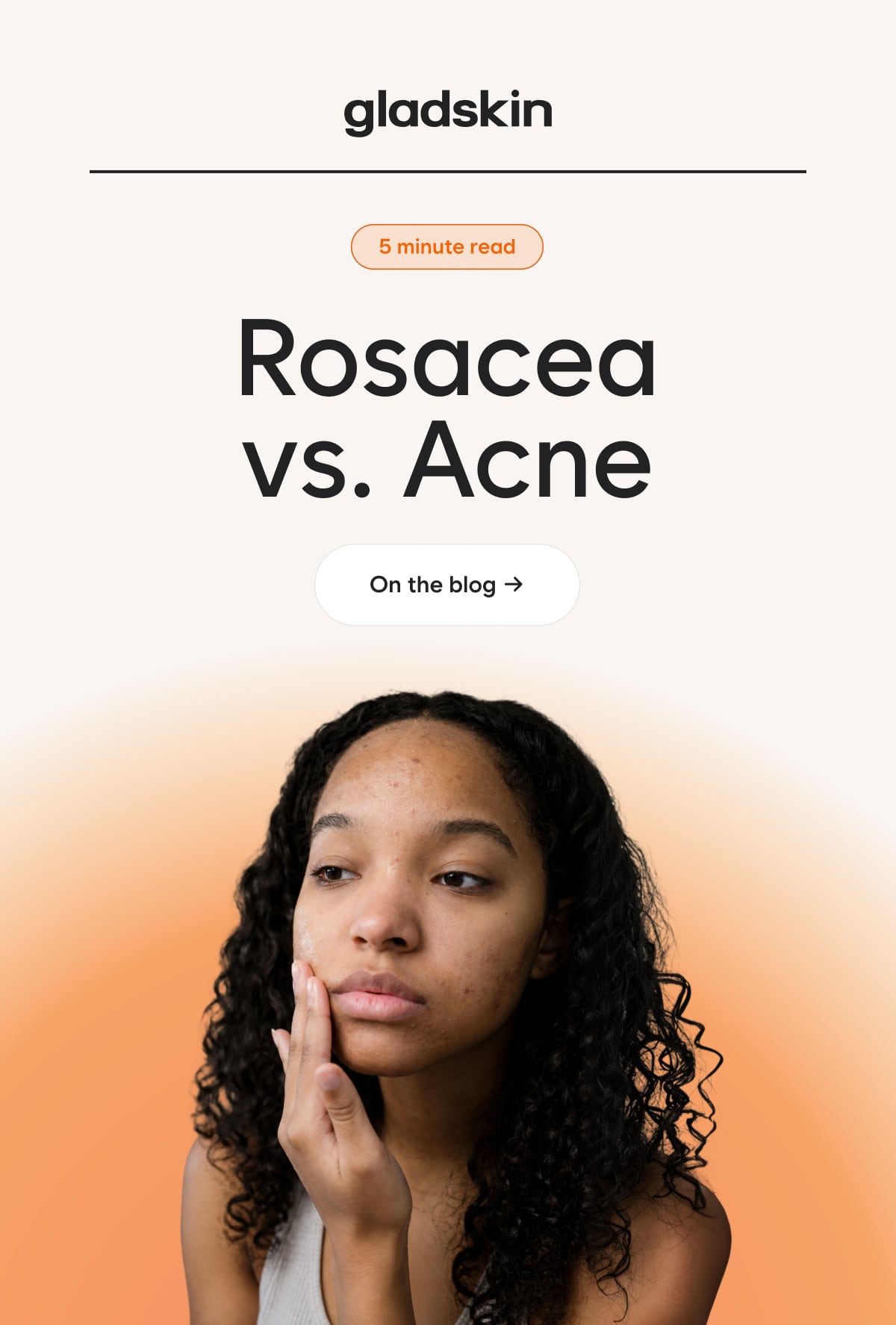 Rosacea vs. Acne On the Blog →  