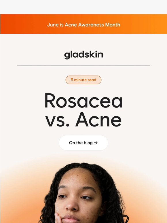 Could your "acne" really be rosacea?