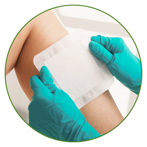 Wound Dressings