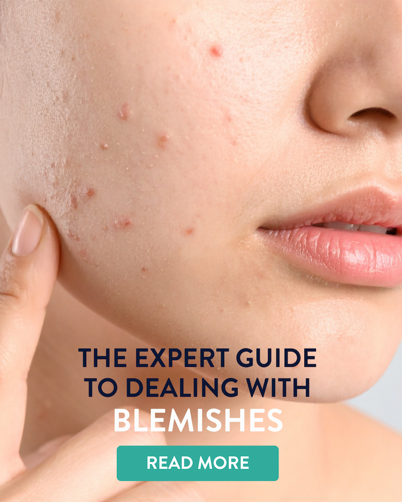 The expert guide to dealing with blemishes