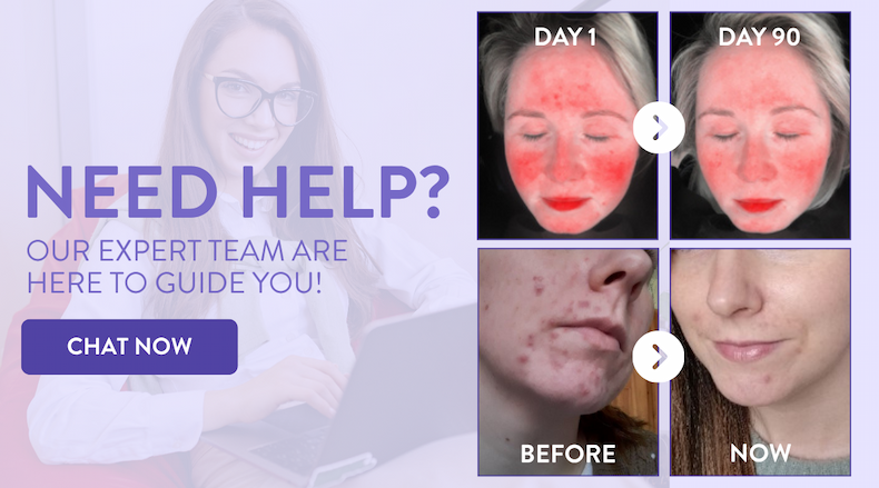Chat to our team of experts