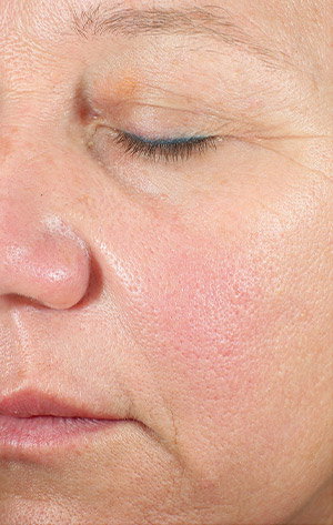 Woman's face with visible pores and wrinkles